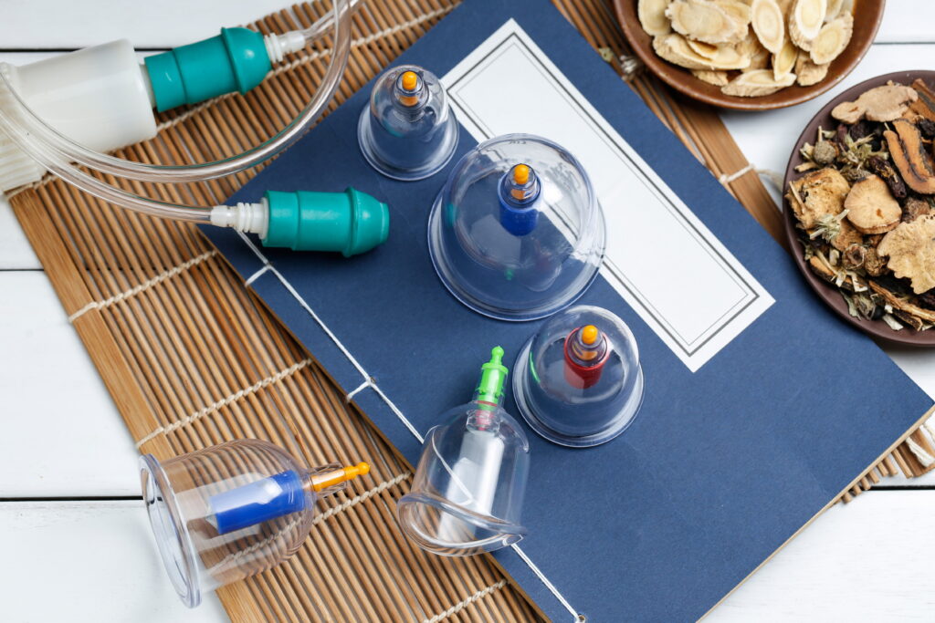 Cupping Therapy